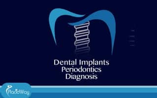 Slider image (1) Dental Implants Periodontics Diagnosis